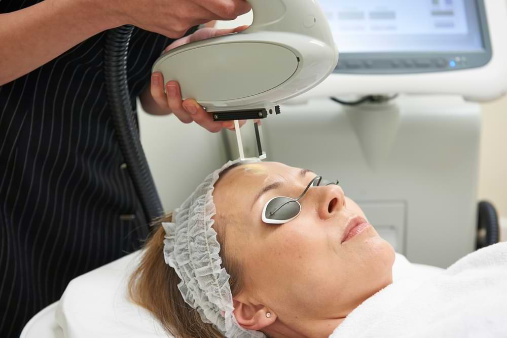 Intense Pulsed Light IPL treatment for dry eyes